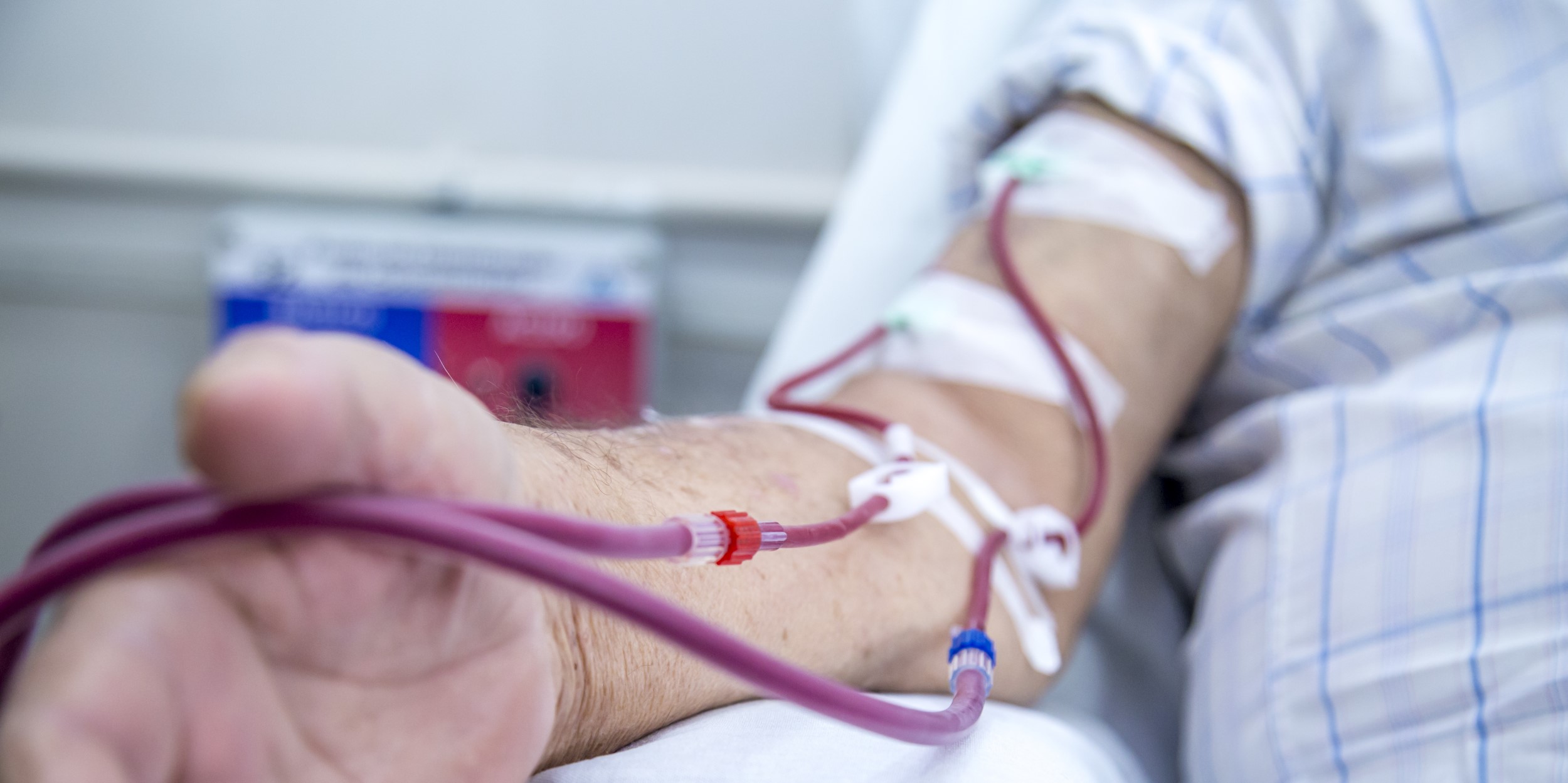 What is Dialysis and When do I Start?
